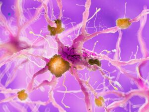 nerve damage in a microscopic level
